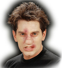 Zlomený nos