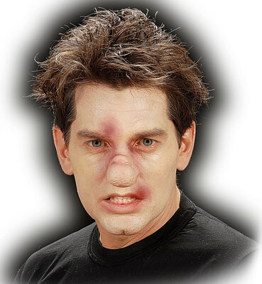 Zlomený nos